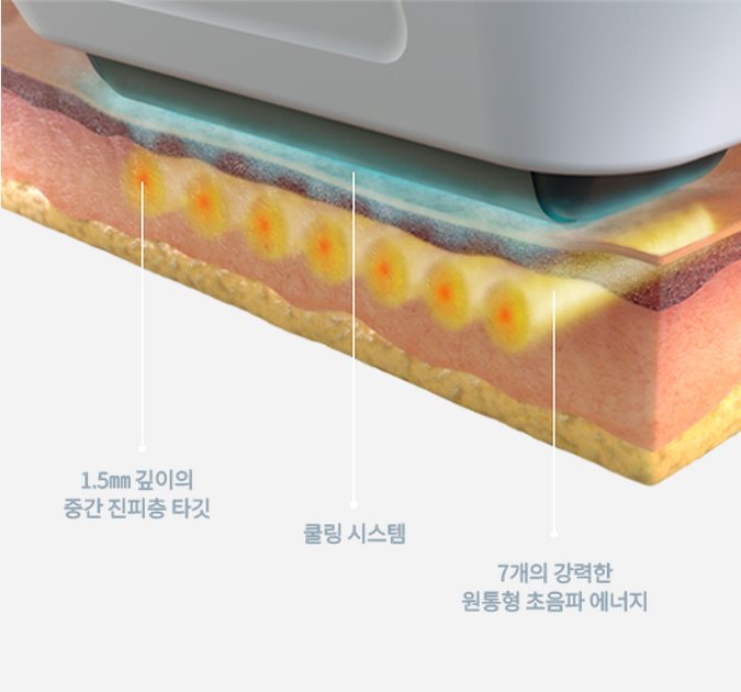 소프웨이브 라운지 - 진피층에 집중하는 탄력 리프팅