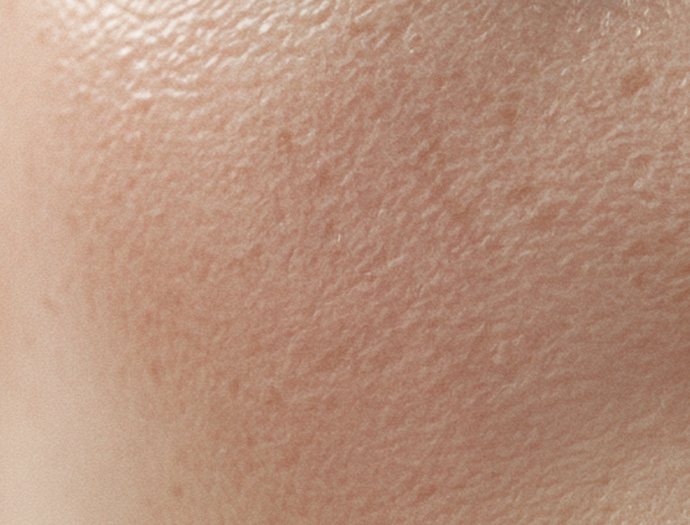 커스텀 색소케어 - 피부톤이 전체적으로 칙칙한 피부