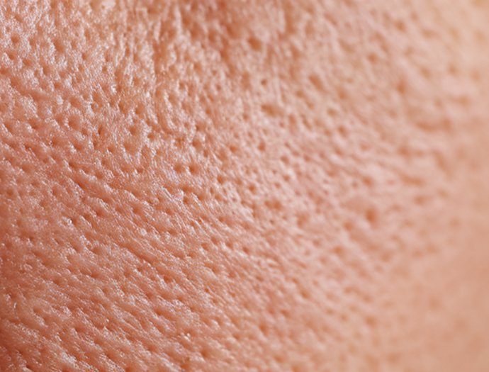 프리미엄 모공케어 - 볼 모공이 늘어져 보이는 피부